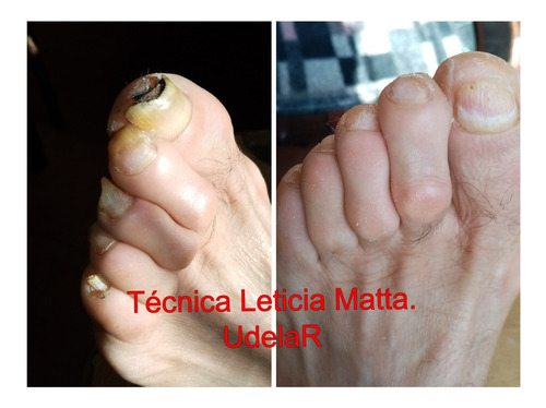Imagen 6 de 8 de Podologa