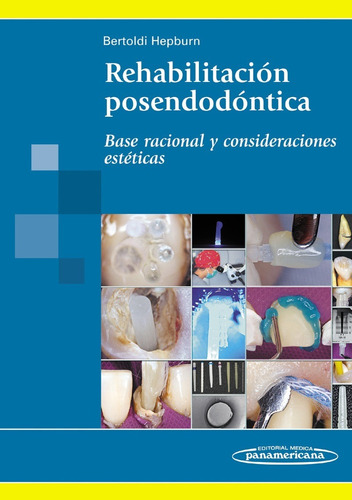 Rehabilitación Posendodóntica - Bertoldi - Panamericana