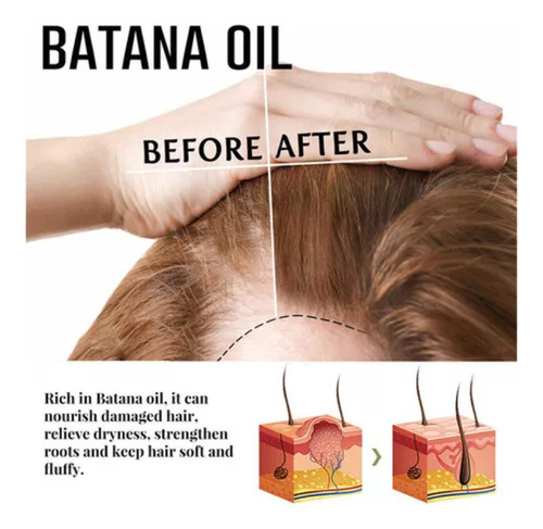 W Shampoo Óleo Batana Para Crescimento - 100ml * 2 Unidades