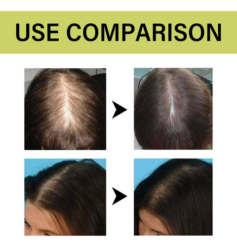 Este Shampoo É O Ingrediente Principal E Está Em Vitaminas E