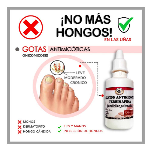 Gotas Para Hongos De Uñas