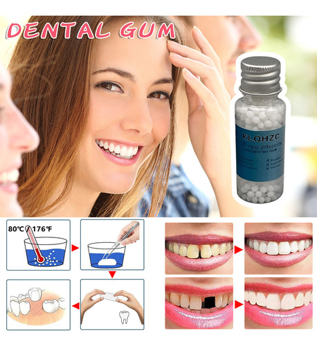 Para Dientes Faltantes Dientes Con Cuentas Para Una Restaura