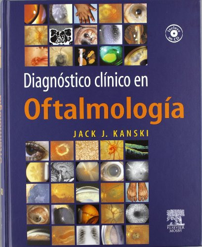 Libro Diagnostico Clinico En Oftalmologia  De Jack J. Kanski