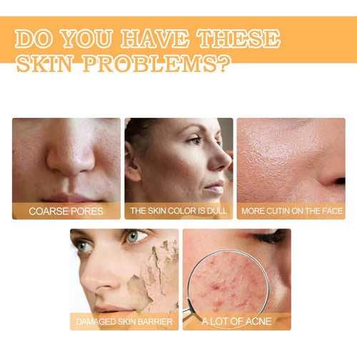 1×exfoliante Facial Con Ácido Glicólico 7%, Astringe Los Po