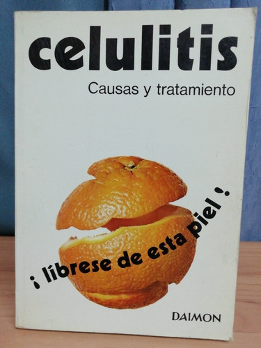 Celulitis Causas Y Tratamiento