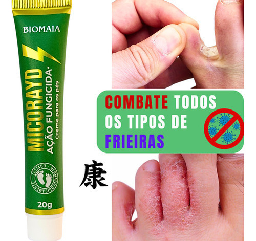 Micorayd Melhor Que Decreina Frieiras Micoses Fungos