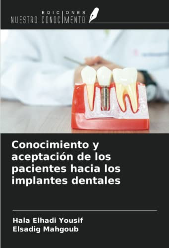 Conocimiento Y Aceptacion De Los Pacientes Hacia Los Implant