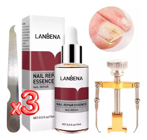 Set 2pz Lanbena Esencia Reparadora Uñas Y Removedor Uñas