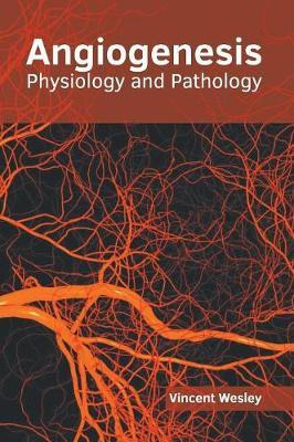 Libro Angiogenesis: Physiology And Pathology - Vincent We...