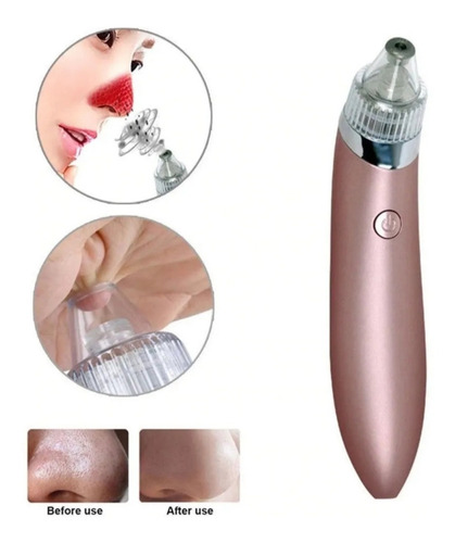 Removedor Extractor Puntos Negros Espinillas Limpieza Facial
