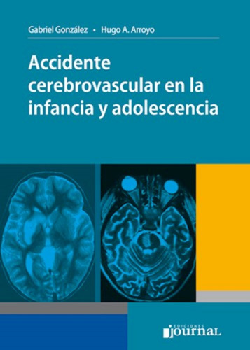 Accidente Cerebrovascular En Infancia Y Adolescencia.arroyo