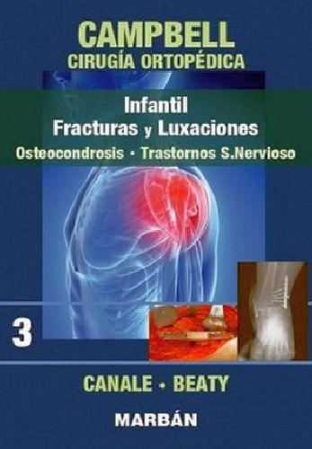 Infantil Fracturas Y Luxaciones (3) Premium