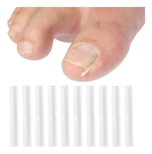 Kit De Uña Encarnada Juego Corrector De Uñas Encarnadas L