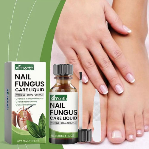 Los Hongos De Las Uñas Tratan Los Dedos De Los Pies Antifúng