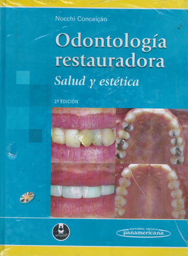 Odontología Restauradora - Nocchi Conceicao