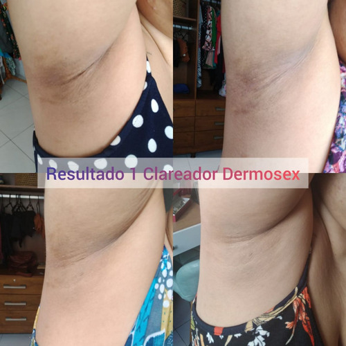 Clareador Virilha Suvaco Axila Creme Firmador De Bumbum Kit