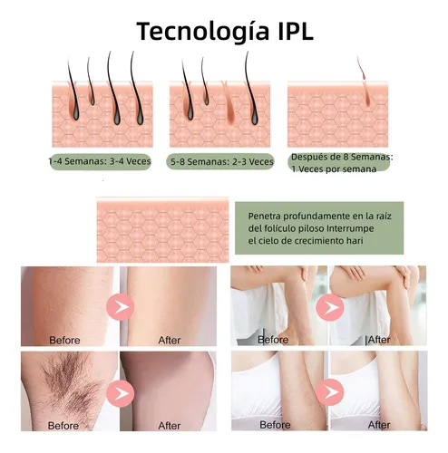 Depiladora Láser Permanente De Luz Pulsada Ipl Indolora