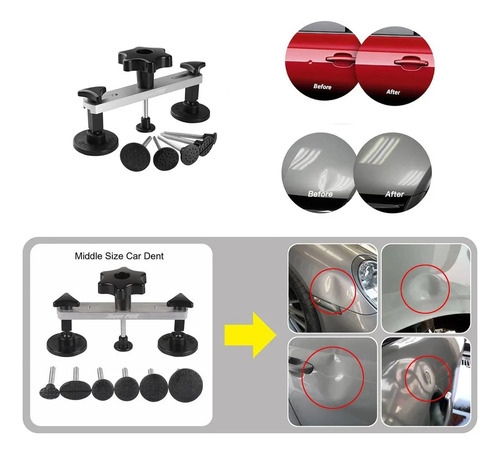 Kit Ventosa Saca Golpes De Auto De Ventosa Abolladuras 77pcs