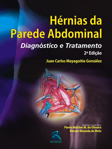 Hérnias da Parede Abdominal, de Mayagoitia, Juan Carlos. Editora Thieme Revinter Publicações Ltda, capa dura em português, 2015