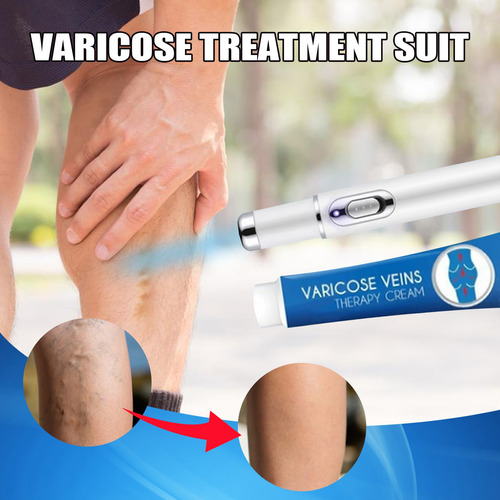 Crema De Tratamiento Para Varices J Pomada Para Venas Varico