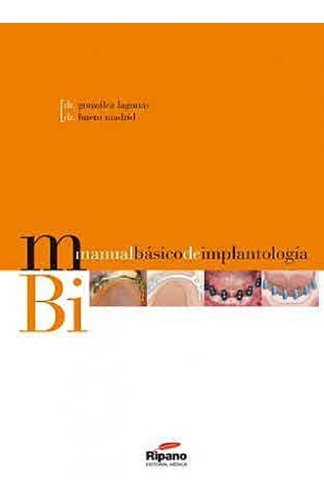 Manual Basico De Implantologia Lagunas Ripano