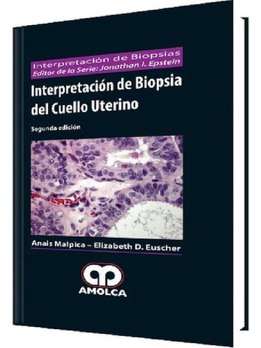 Libro - Interpretación De Biopsia Del Cuello Uterino. 2ª Ed