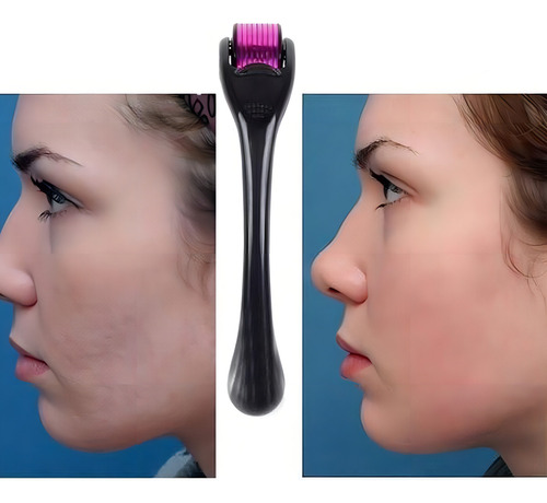 Dermaroller Facial Derma Roller Barba 0.5mm Regenerador Piel