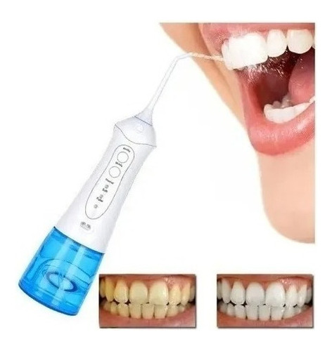 Limpiador Enjuagues Bucal Irrigador Dental Portatil/5037 Color Blanco