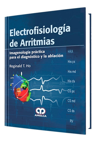 Electrofisiología De Arritmias. Súper Remate Amolca.