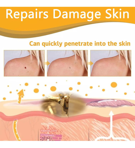 A 3pcs Tag Recede Bee,tag Recede Bee Spray Para Mujeres Y