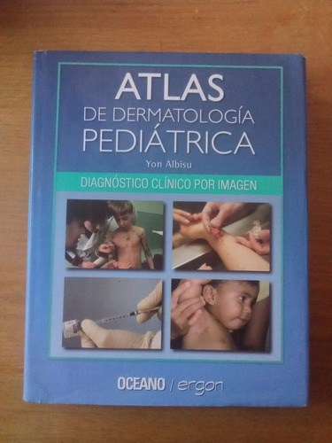 Atlas De Dermatología Pediátrica - Yon Albisu 