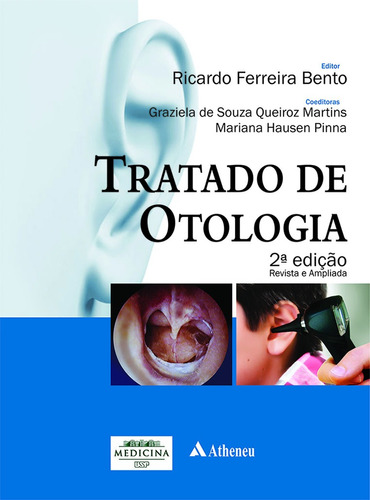 Tratado de otologia, de Bento, Ricardo Ferreira. Editora Atheneu Ltda, capa mole em português, 2013