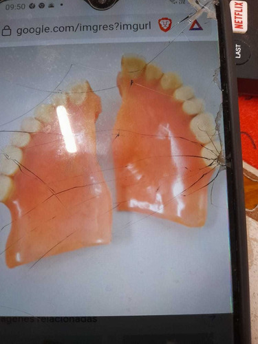Imagen 1 de 1 de Reparacion De Protesis,mecanica Dental Directo