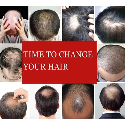 Ci Simulación Peluca Negra Cabello Corto Para Hombres C