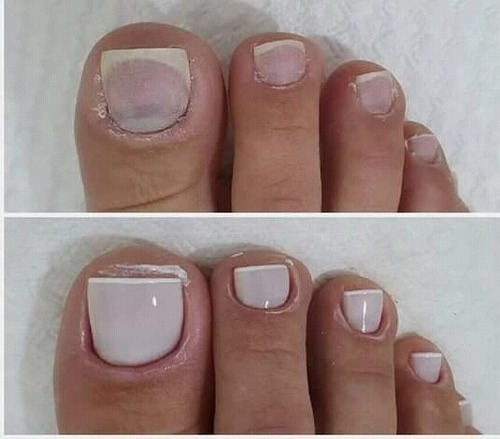 Imagem 1 de 5 de Manicure,pedicure E Spar Dos Pes. Atendimento Domiciliár