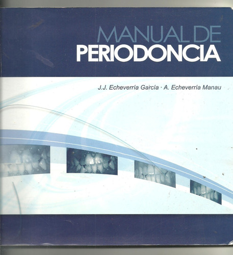 Manual De Periodoncia Echeverria