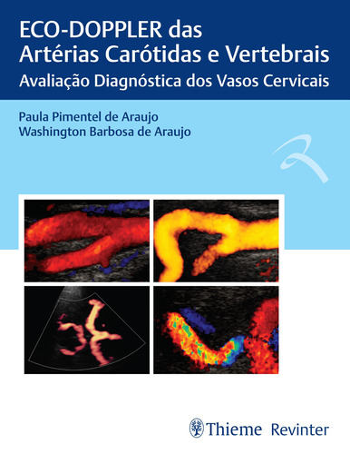 ECO-DOPPLER das Artérias Carótidas e Vertebrais: Avaliação Diagnóstica dos Vasos Cervicais, de Araujo, Paula Pimentel de. Editora Thieme Revinter Publicações Ltda, capa dura em português, 2020