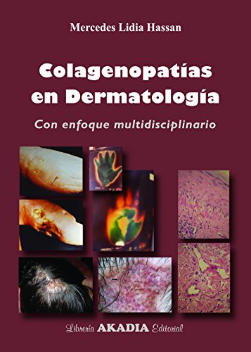 Libro Colagenopatías En Dermatología De Mercedes Lidia Hassa