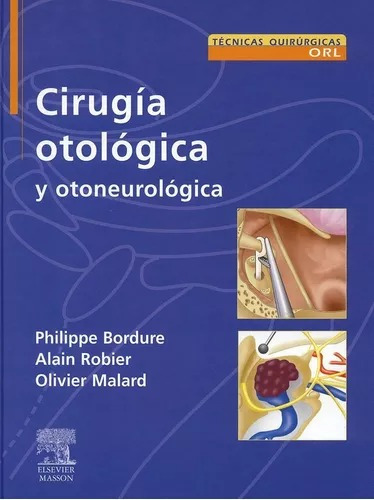 Cirugía Otológica Y Otoneurológica