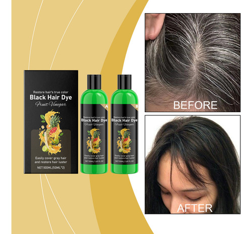 Vinagre De Frutas Um Shampoo Tinge Facilmente L 100ml B Ting