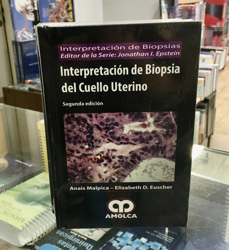 Interpretacin De Biopsia Del Cuello Uterino  2da Ed,jk
