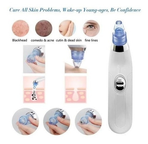 Imagem 2 de 6 de Aparelho Removedor Sucção Cravos Espinhas 4em1 Dermasuction