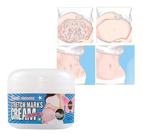 Imagen 2 de 6 de Crema Antiestrias Posparto Estiramiento Baba Caracol 2 Pzas