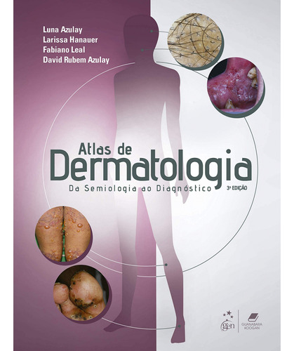 Livro Atlas De Dermatologia Da Semiologia Ao Diagnóstico