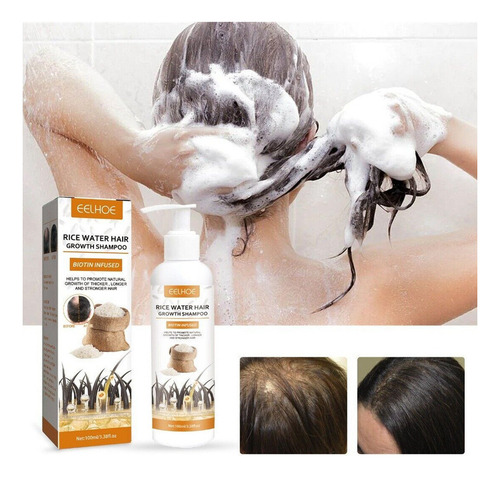 Xinnuo ChampĂș Para El Crecimiento Del Cabello De 200ml Para
