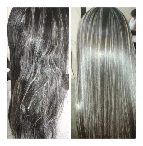 Cirugia Capilar Celulas Madres Litro S - L a $44000