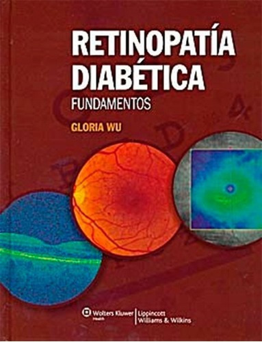 Retinopatia Diabetica - Fundamentos - Wu, Gloria (papel)