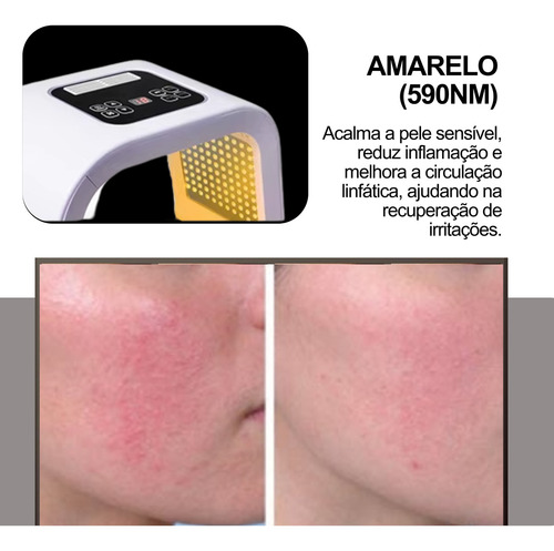 Cabine Cromoterapia Led 7 Cores Tratamento Terapia Facial Instrumento De Beleza De Espectro Colorido Remoção De Acne E Rejuvenescimento Da Pele Com Tecnologia De Fóton Mais Branco Para Sardas