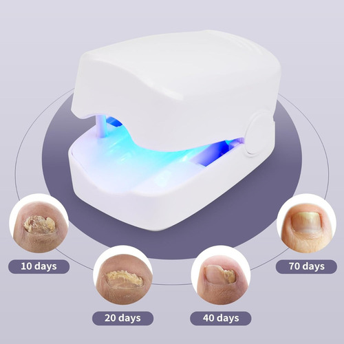Dispositivo De Limpieza Con Luz Para Hongos En Las Uñas Weil