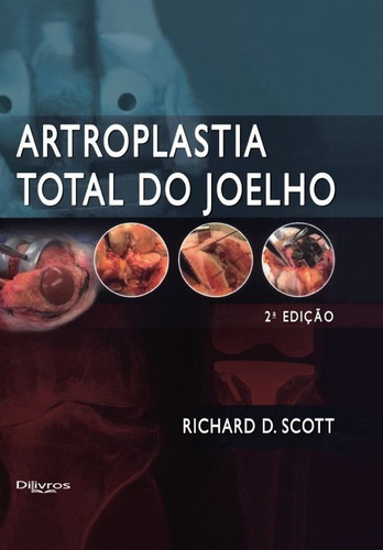 Livro - Artroplastia Total Do Joelho - Scott